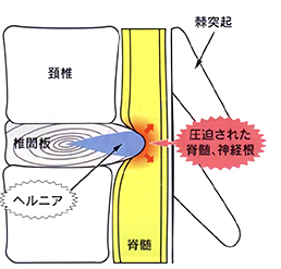 hip_02 hip_02